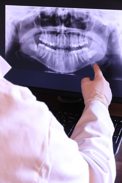 Best Emergency Broken Tooth Repair in Richville, OH
