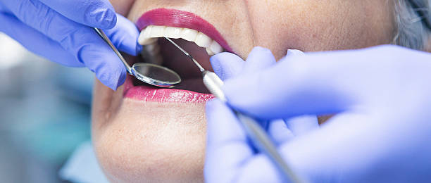 Best Emergency Tooth Extraction in Richville, OH